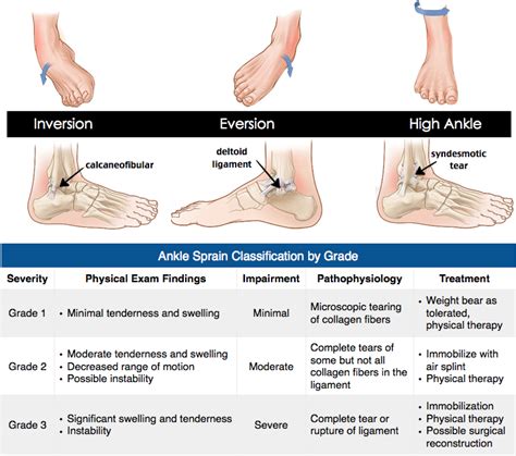 how to assess ankle injury